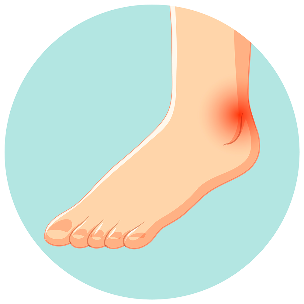 Fodsmerter - ArosKiropraktor