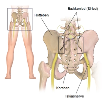 Iskias - ArosKiropraktor